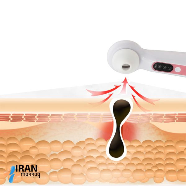 میکرودرم خانگی برای رفع چین و چروک